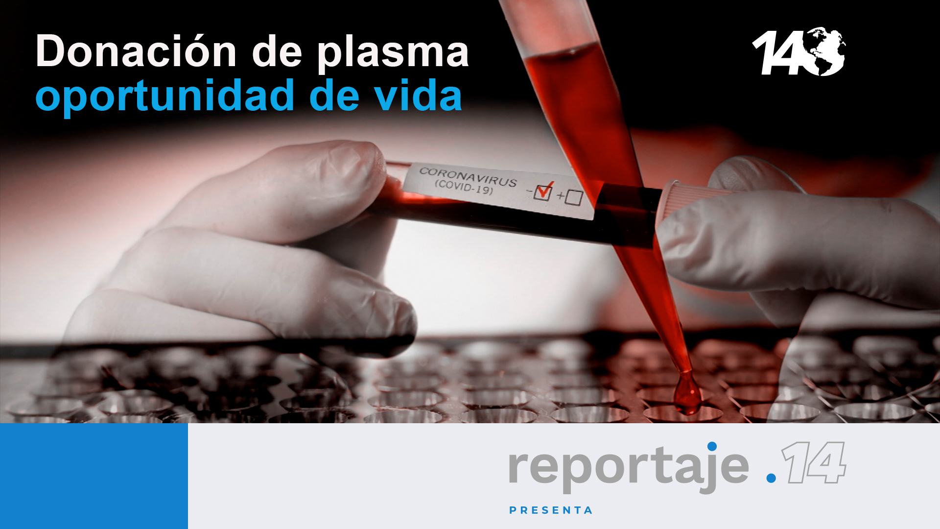 Donación de plasma. Oportunidad de vida